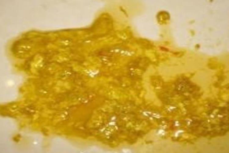 吃鲍鱼过敏腹泻图