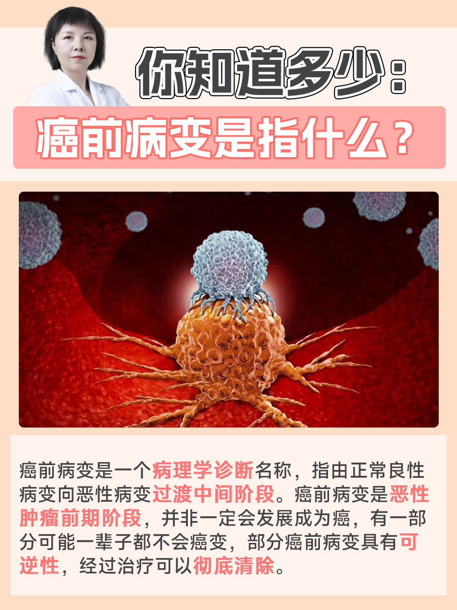 你知道多少:癌前病变是指什么?