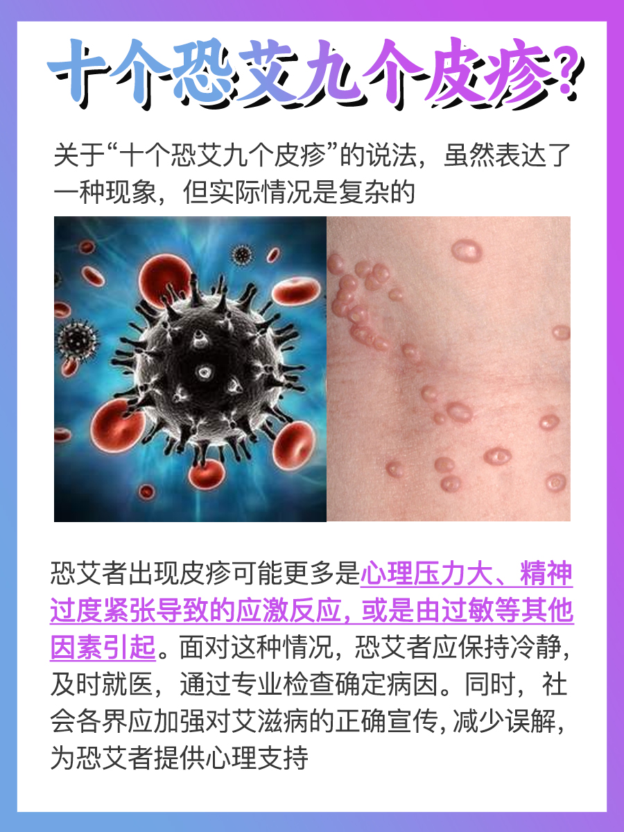 十个恐艾九个皮疹？听听医生怎么说