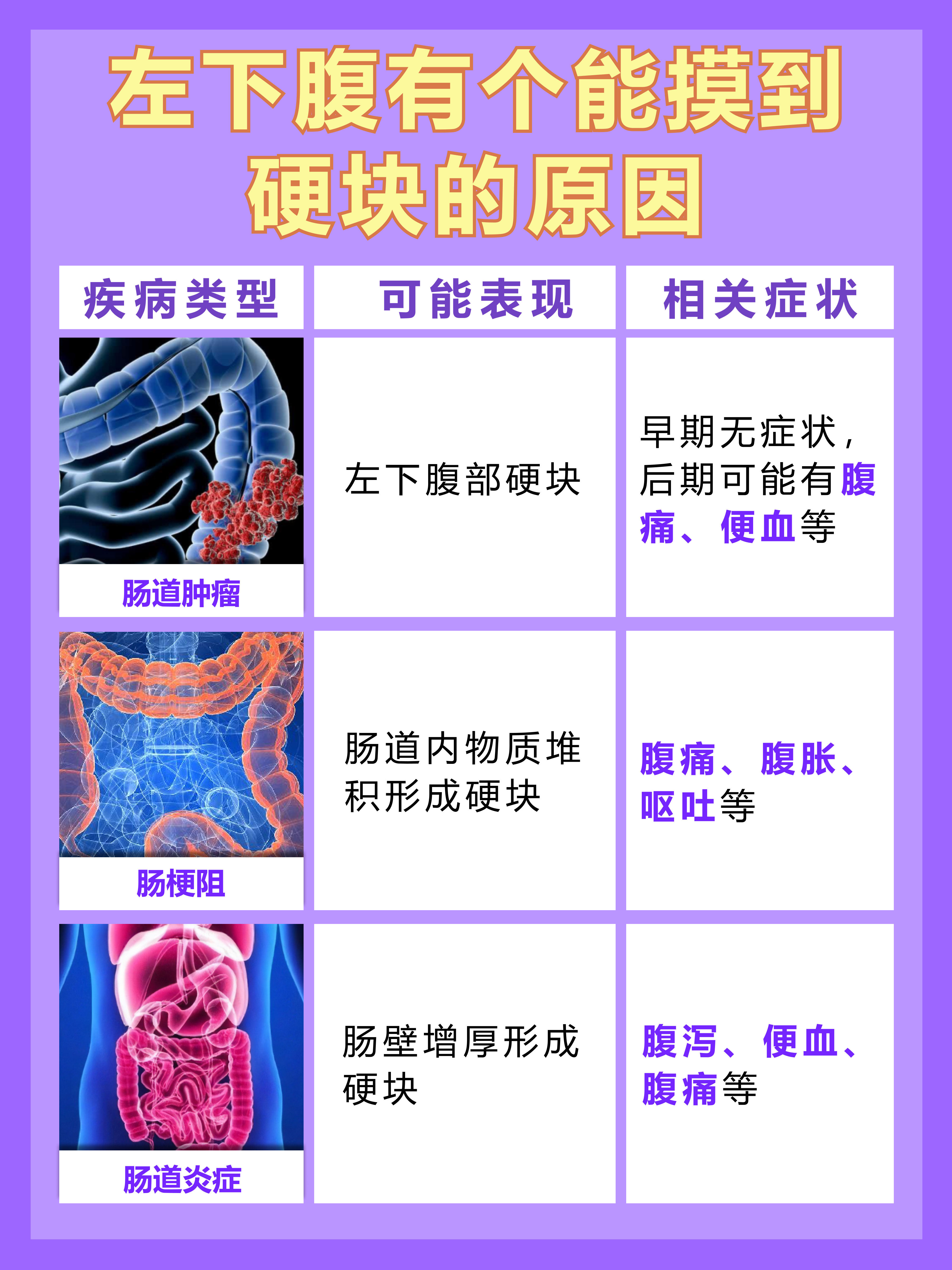 医生解惑：左下腹有个能摸到硬块怎么回事