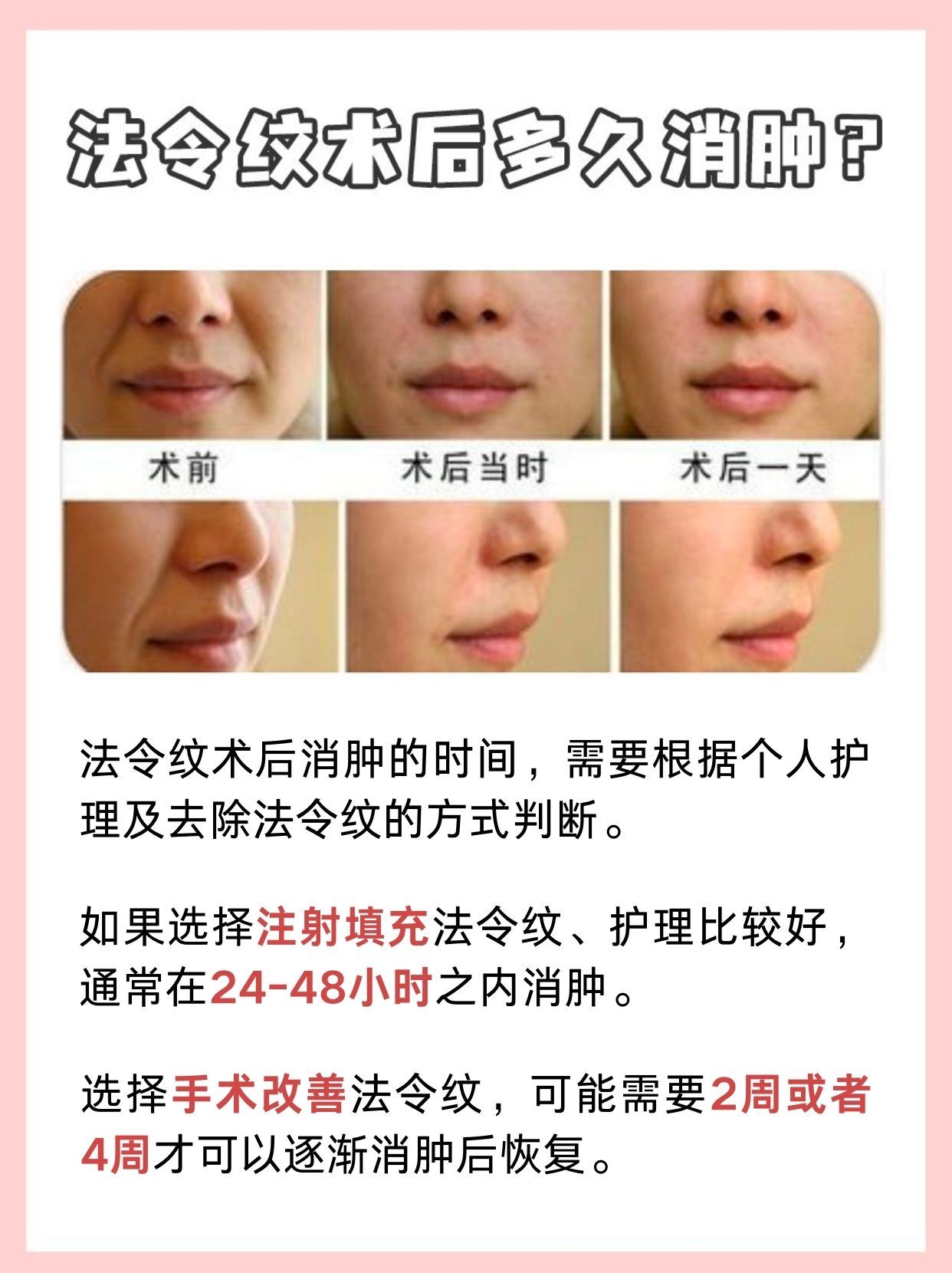法令纹术后多久消肿?医生告诉你答案