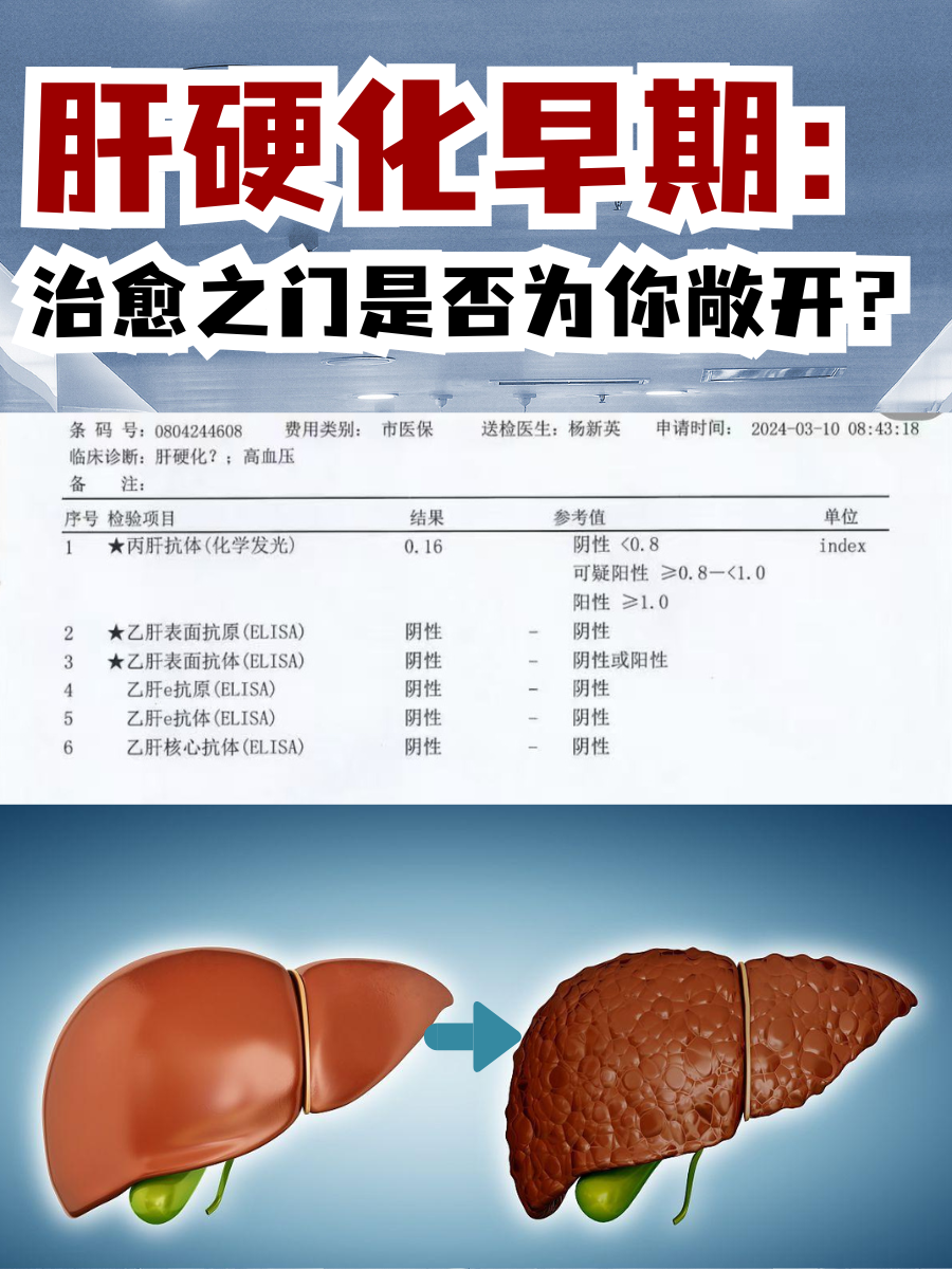 肝硬化早期：治愈之门是否为你敞开？