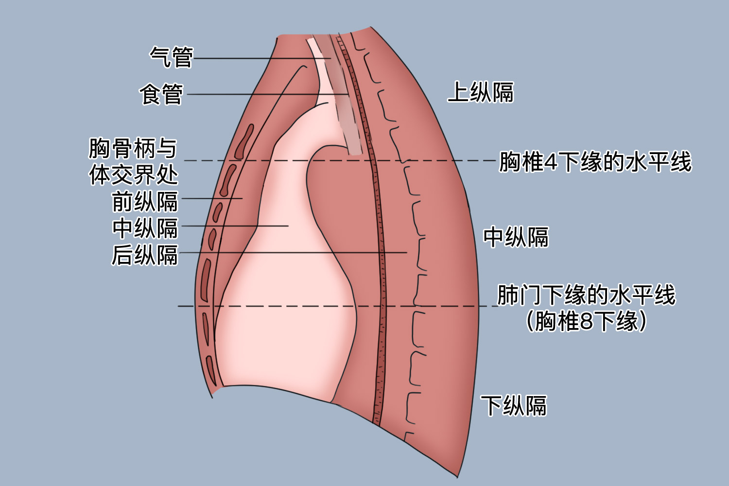 纵膈三分区示意图 纵膈三分区示意图