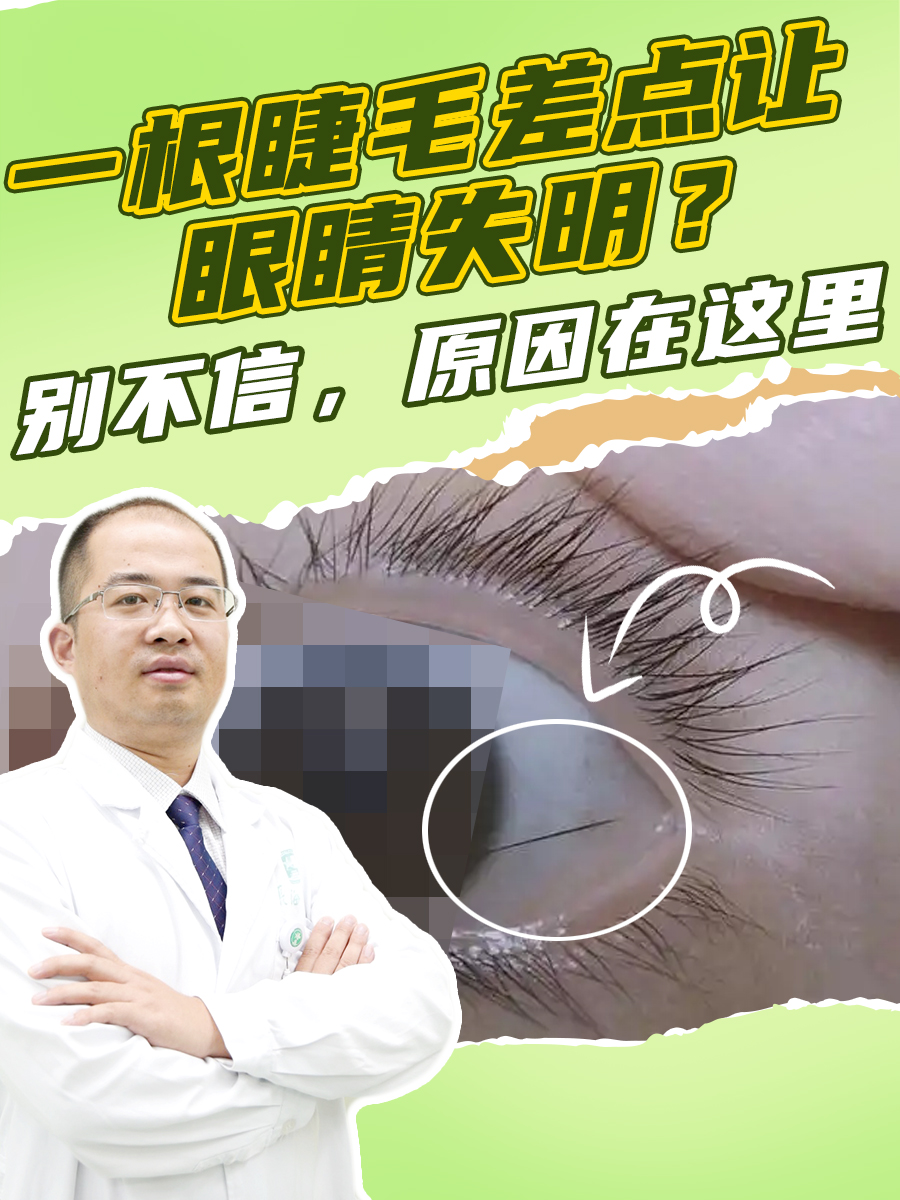 一根睫毛差点让眼睛失明?别不信,原因在这里