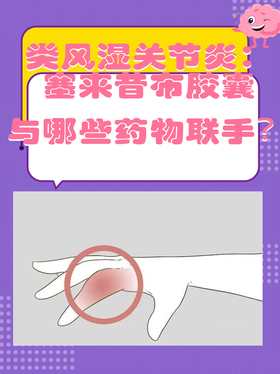 类风湿关节炎：塞来昔布胶囊与哪些药物联手？