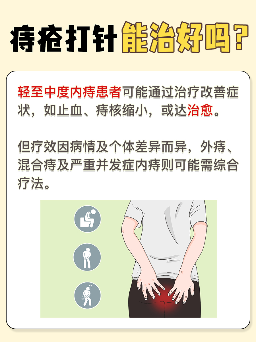 痔疮难题，打针能否化解？