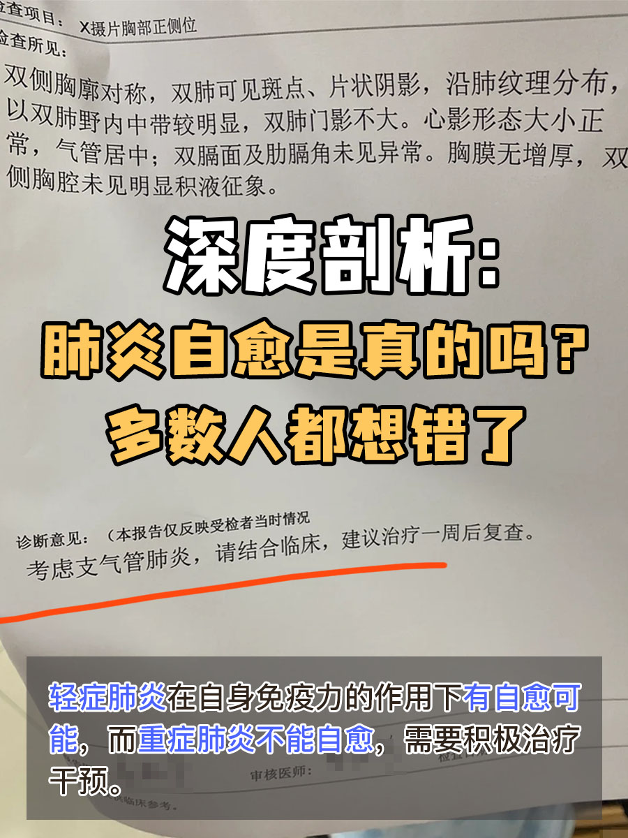 深度剖析：肺炎自愈是真的吗？多数人都想错了