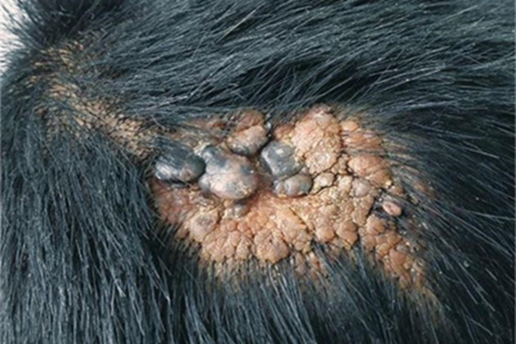 皮脂腺腺瘤头皮疙瘩图