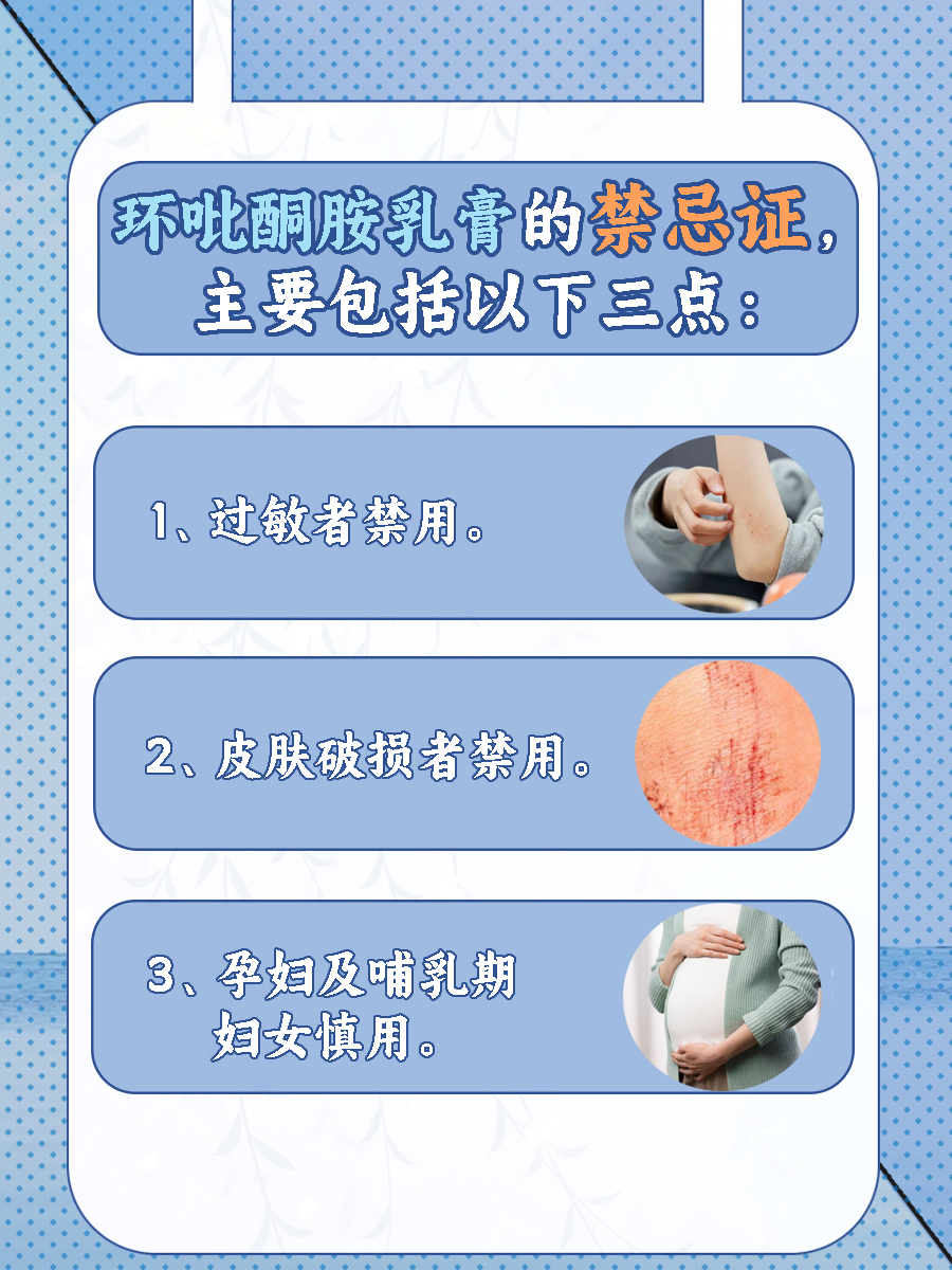 有脚气！环吡酮胺乳膏能治疗吗?