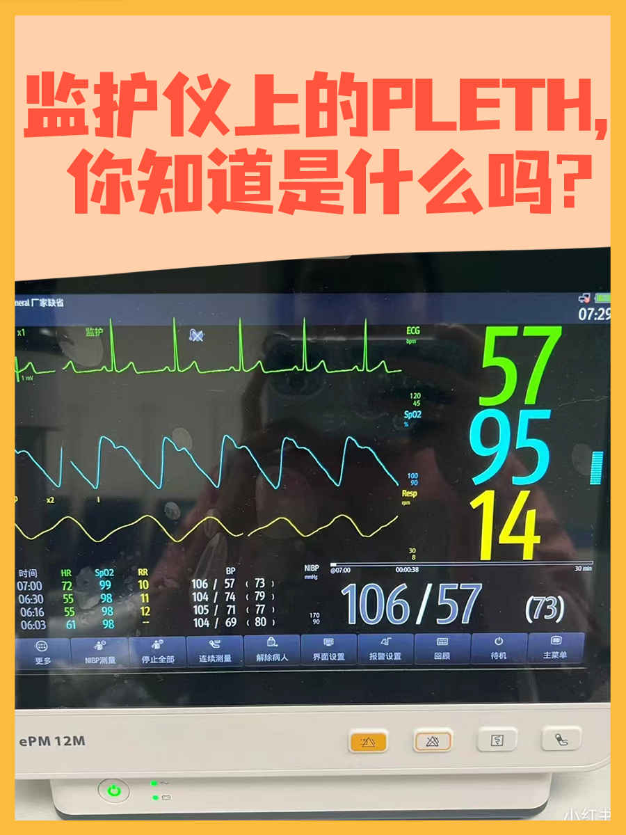 监护仪上的PLETH，你知道是什么吗？