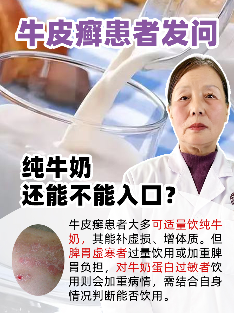 牛皮癣患者发问：纯牛奶还能不能入口？