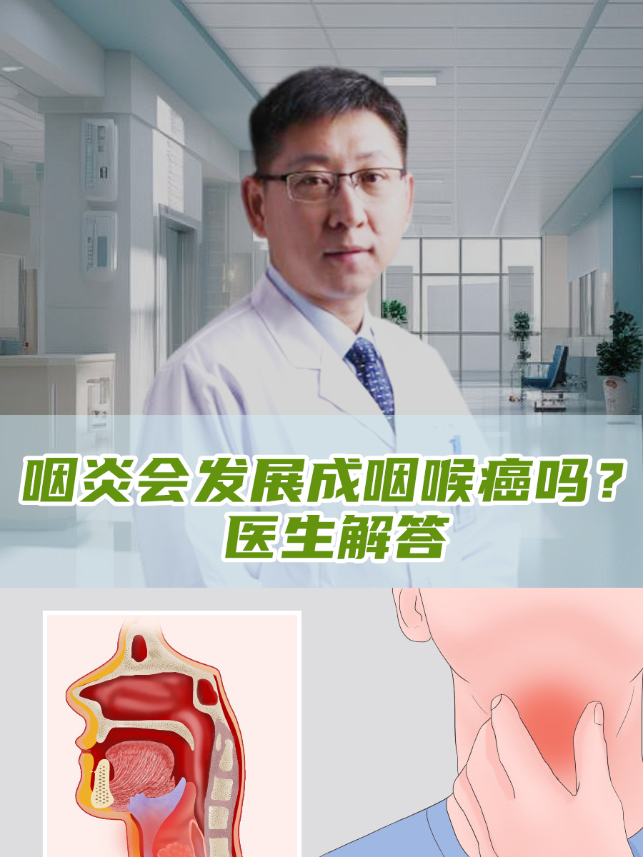 咽炎会发展成咽喉癌吗？医生解答