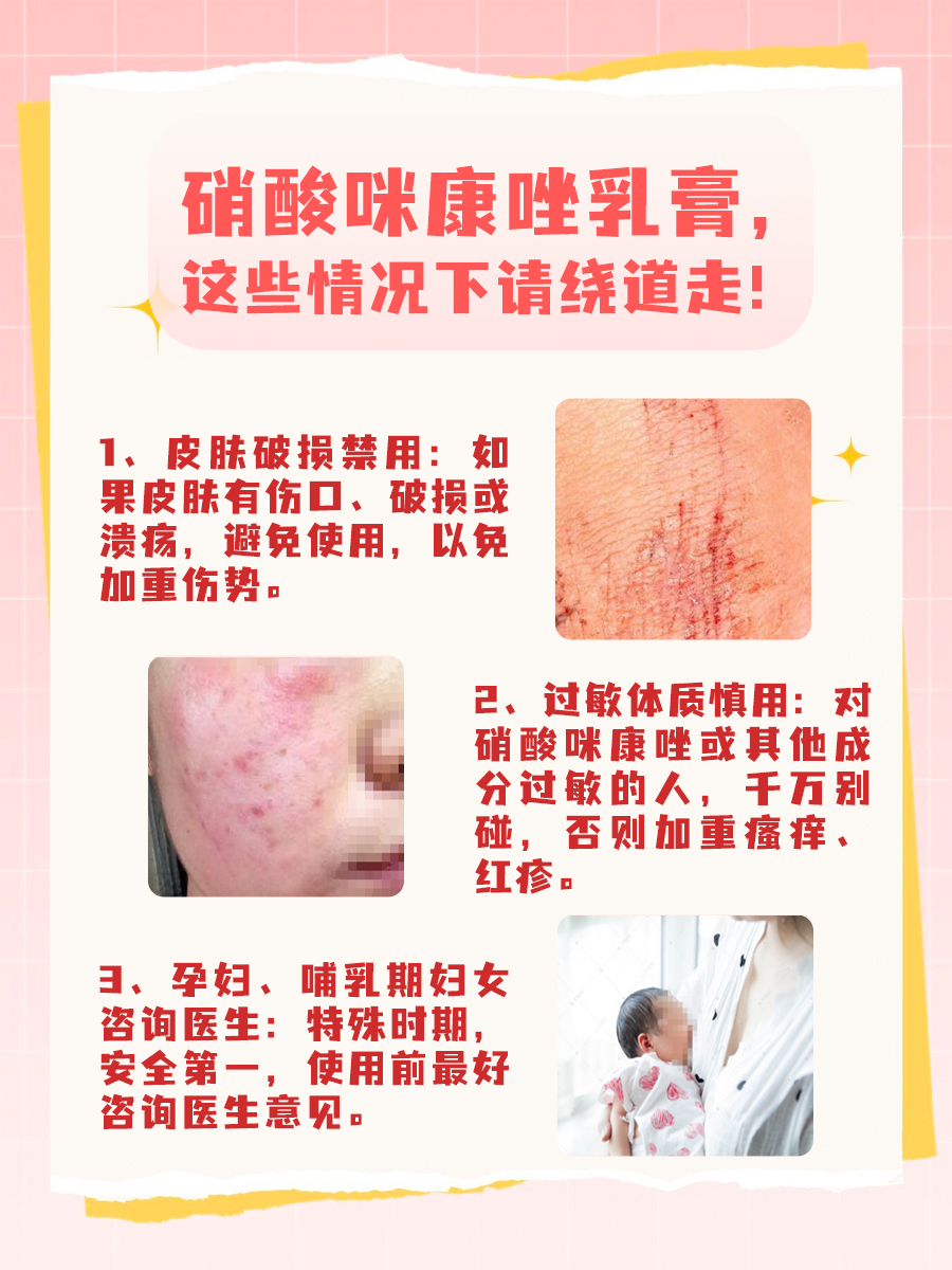 达克宁vs特比萘芬：谁更快见效？