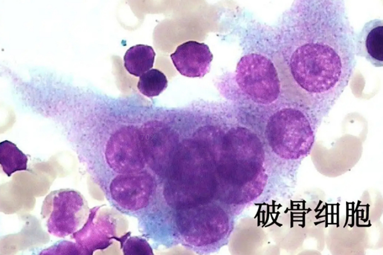 破骨细胞图 破骨细胞图