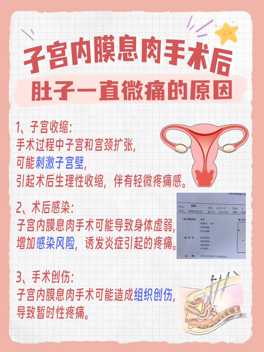 子宫内膜息肉手术后肚子一直微痛:原来是这些原因
