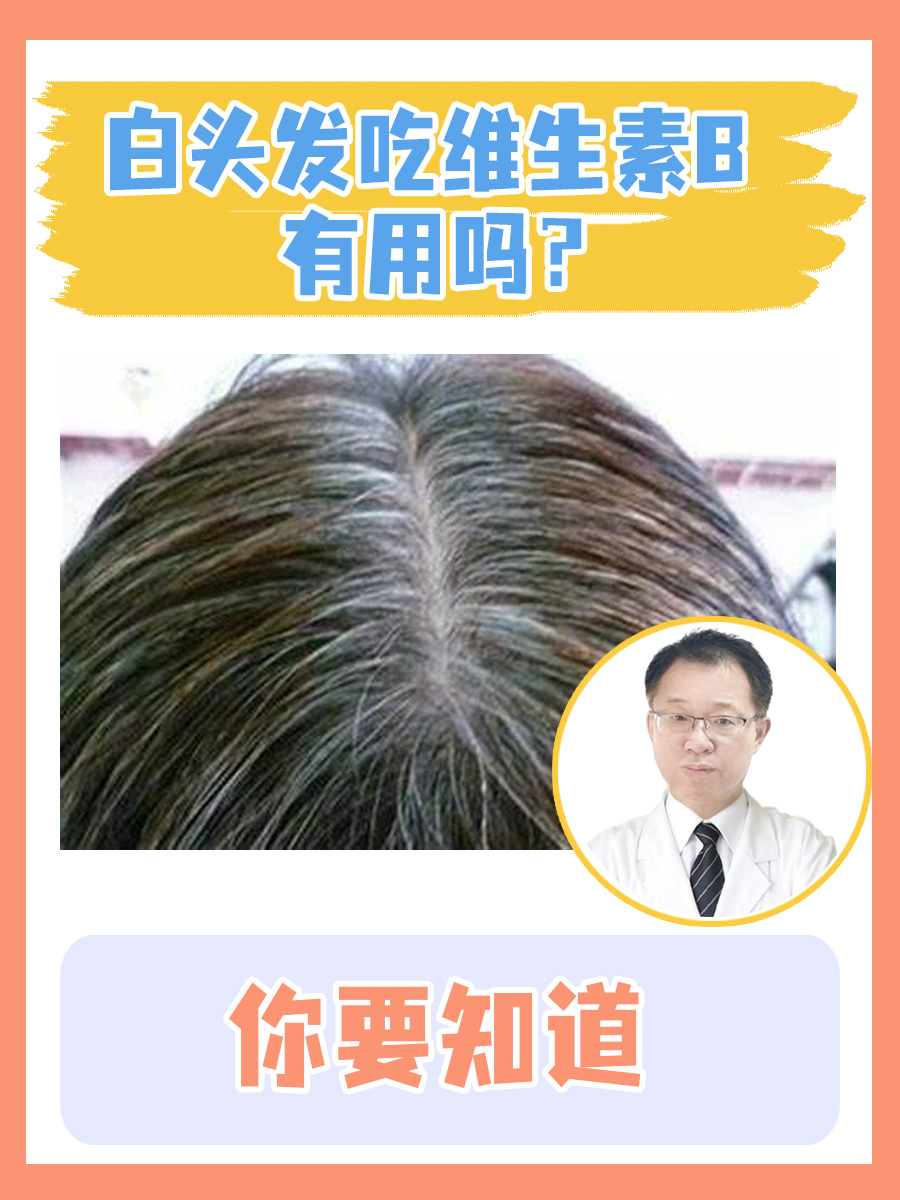白头发吃维生素B有用吗？你要知道