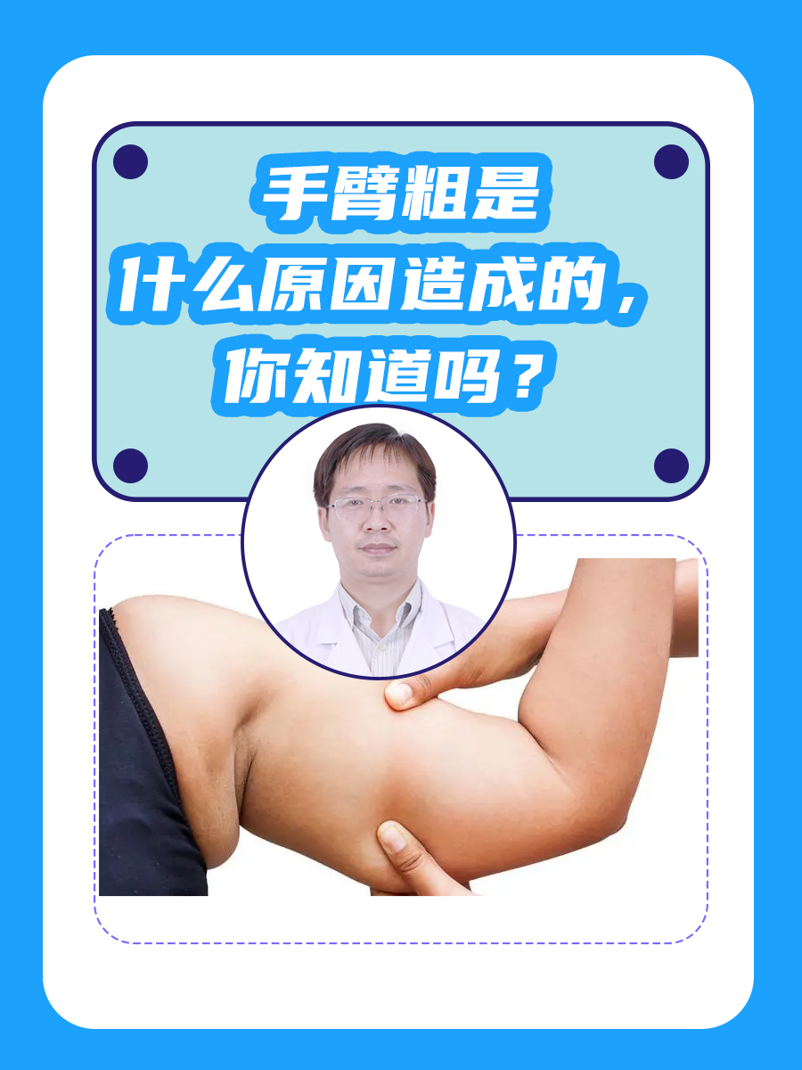 手臂粗是什么原因造成的，你知道吗？