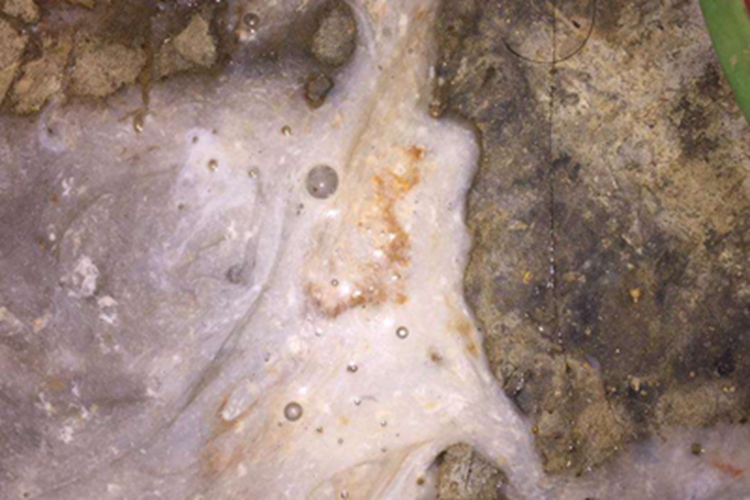 进食辅食后婴儿吐奶图