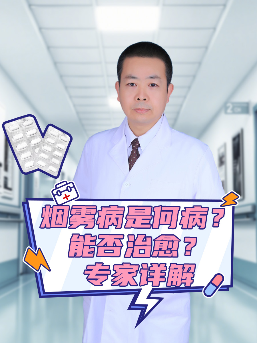 烟雾病是何病?能否治愈?专家详解