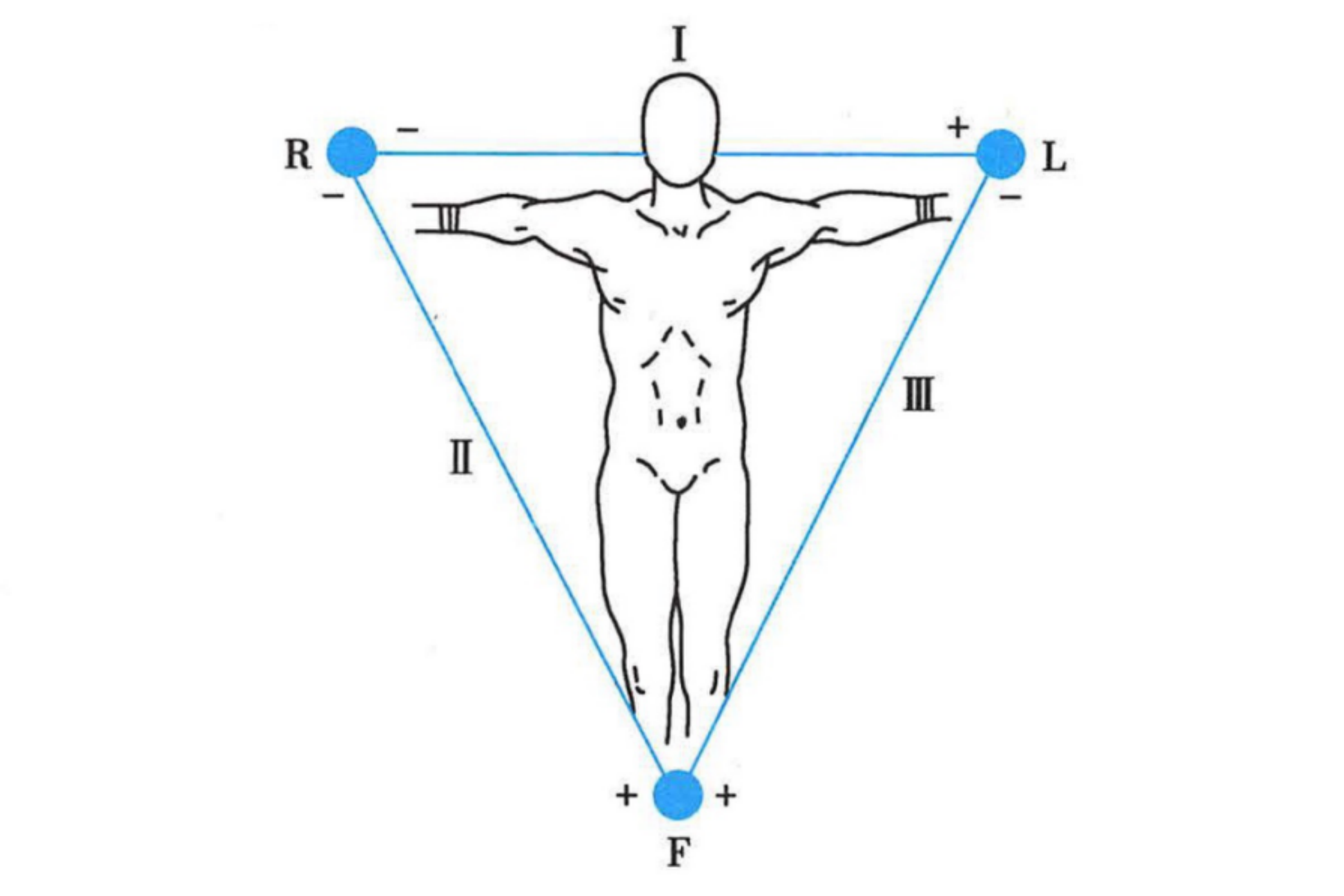 心电图肢体导联位置图