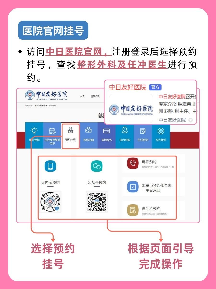 中日友好医院任冲医生怎么样？怎么挂号？