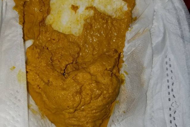 宝宝膏状大便图 宝宝膏状大便图