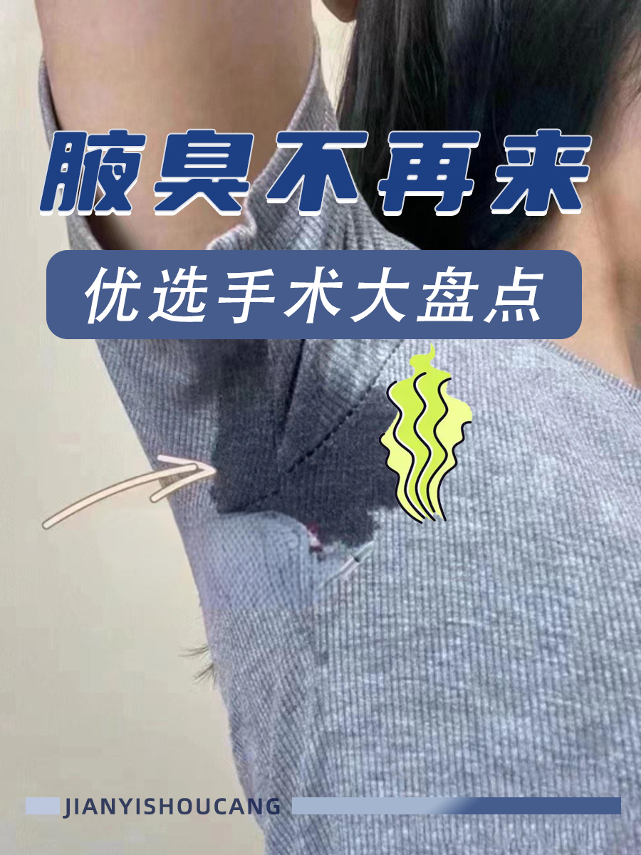 腋臭不再来,优选手术大盘点