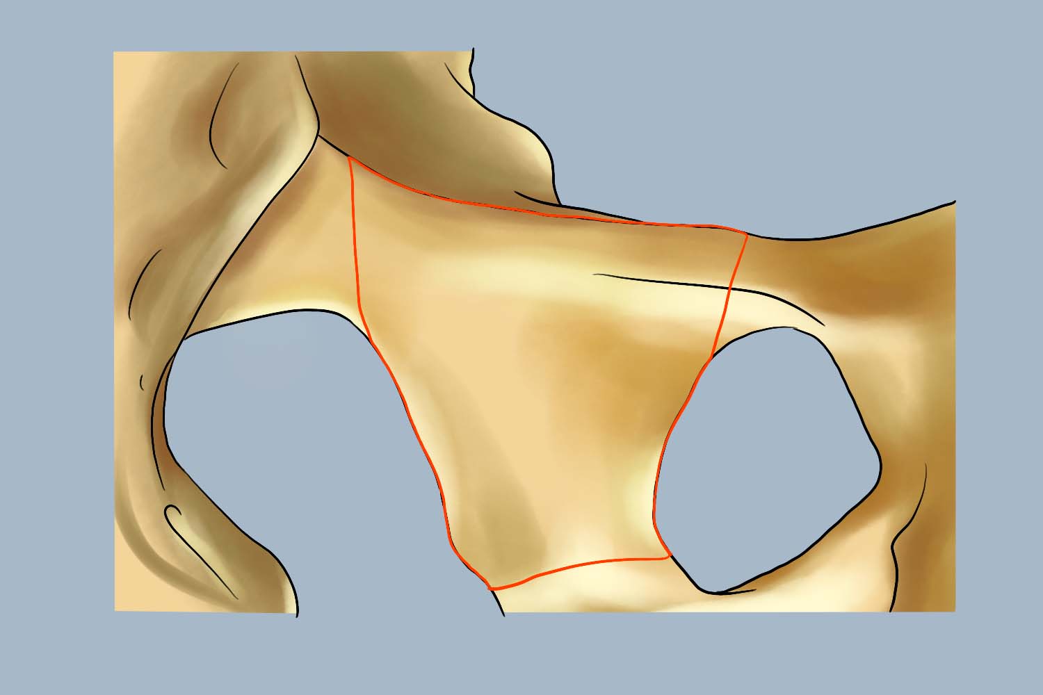 骨盆四边体示意图