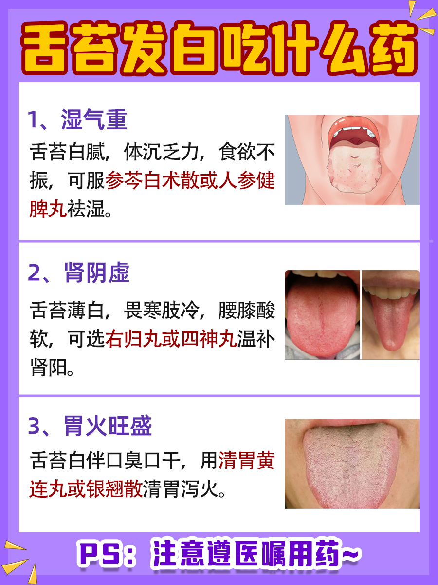 舌苔发白吃什么药 ，名单来了