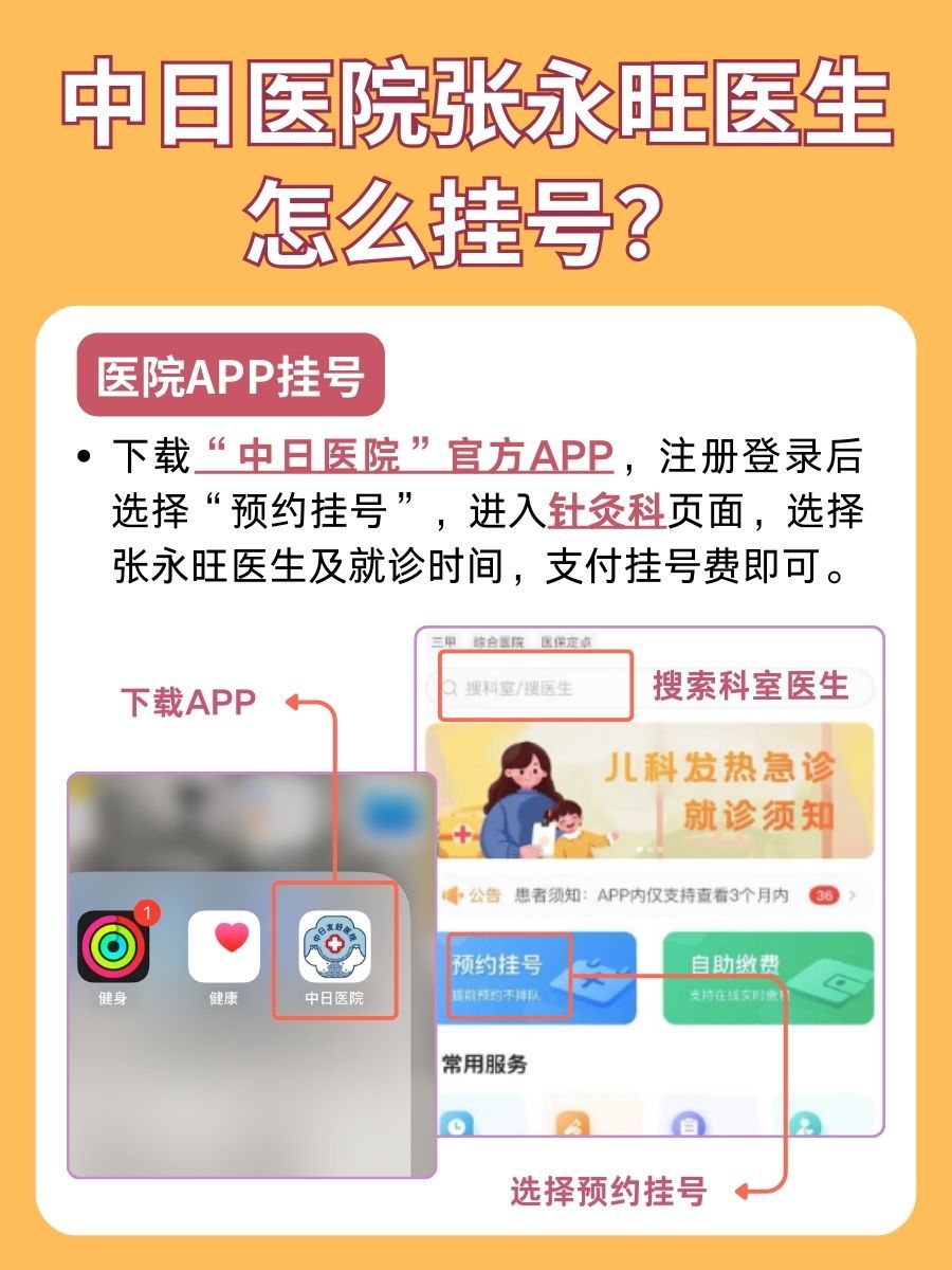 中日友好医院张永旺医生怎么样？怎么挂号？