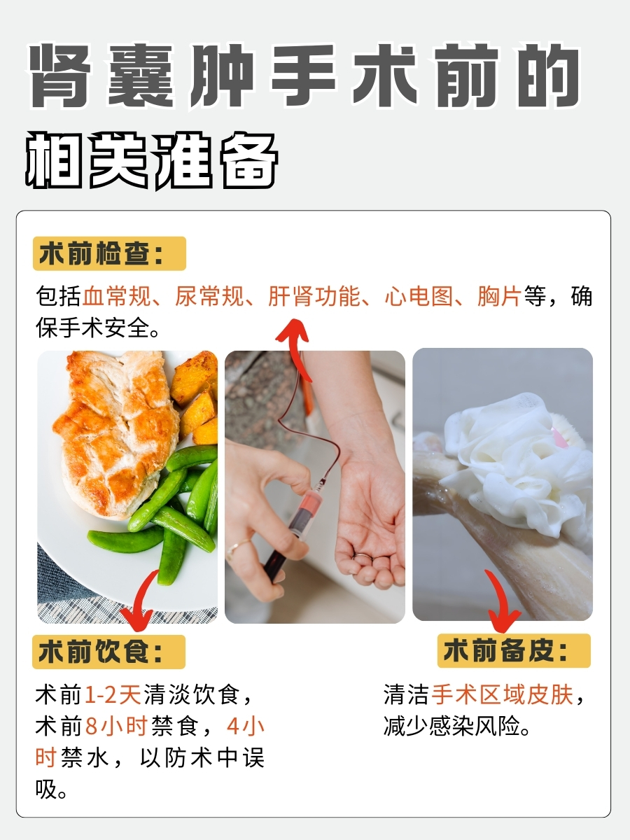 肾囊肿腹腔镜手术，时间你知道要多久吗？