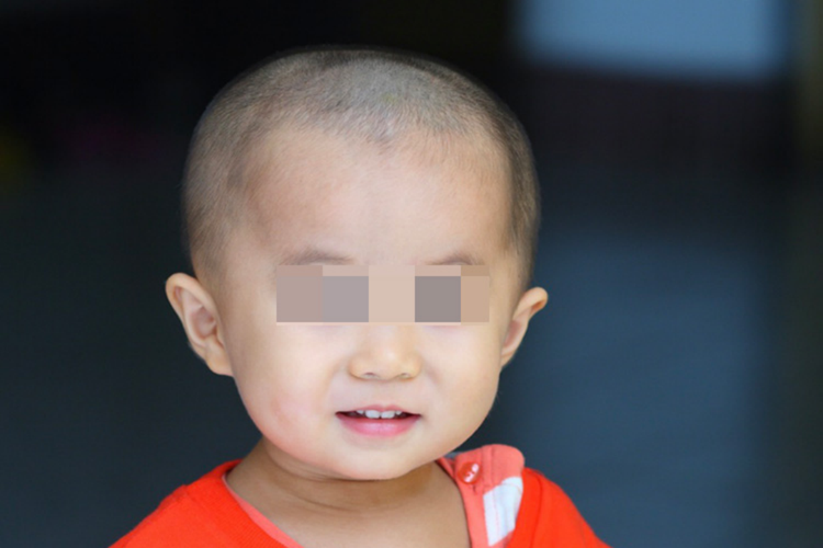 婴儿头两侧有棱角图 婴儿头两侧有棱角图