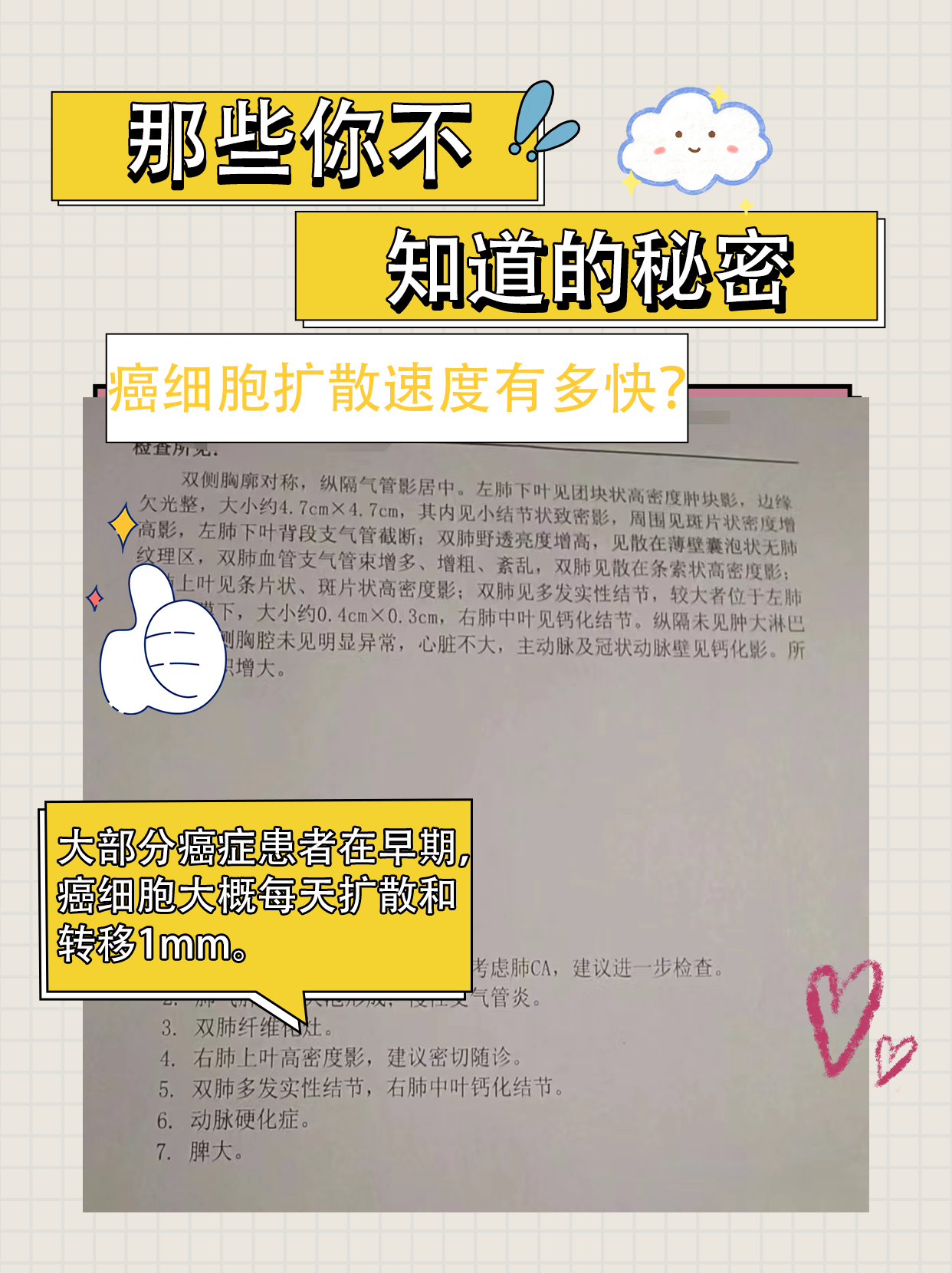 那些你不知道的秘密，癌细胞扩散速度有多快？