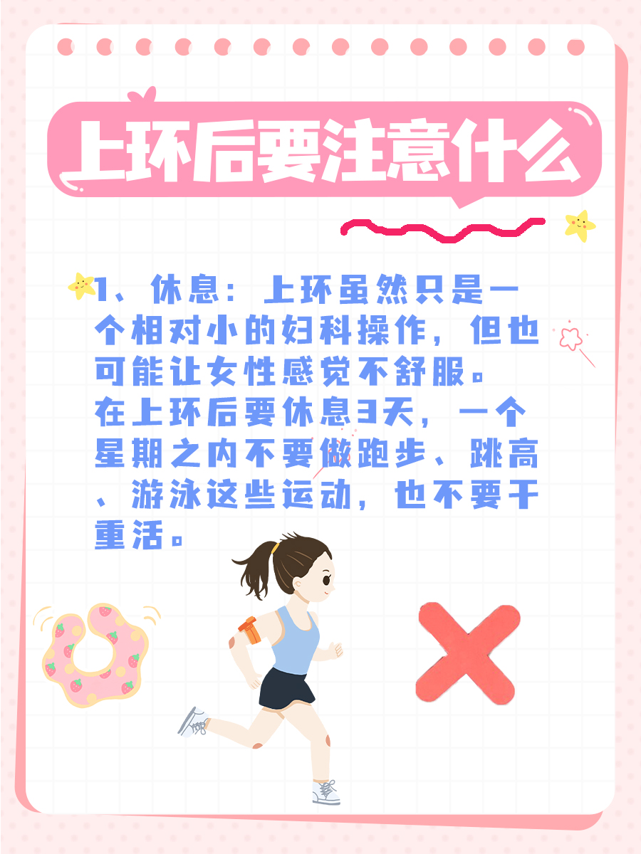节育环解析只之——吉尼环