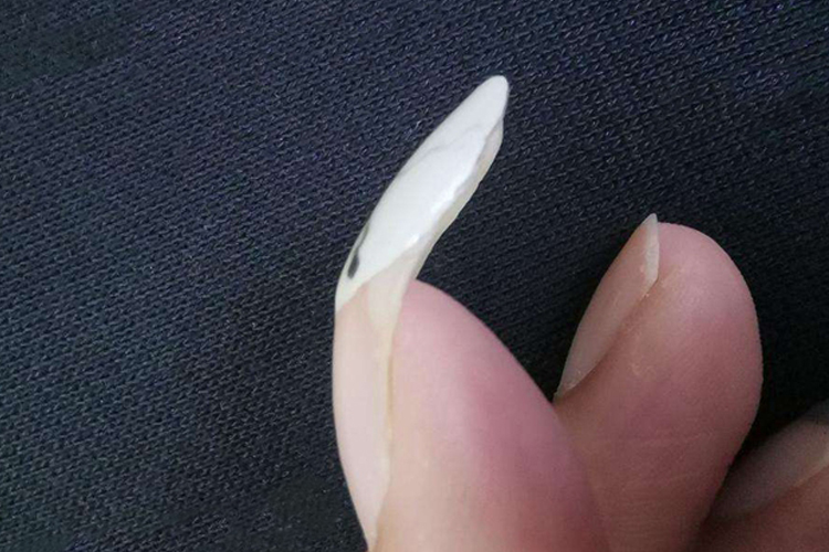 食指指甲向下弯曲图