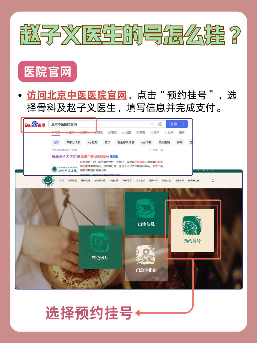 北京中医医院赵子义医生怎么样？怎么挂号？