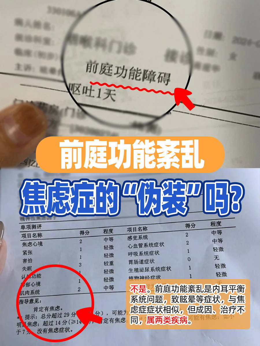 前庭功能紊乱,焦虑症的“伪装”吗?
