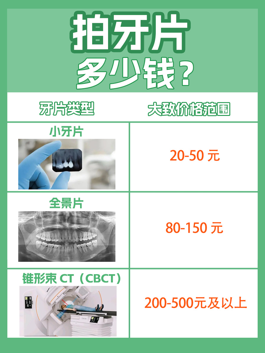 拍牙片多少钱，你知道吗？