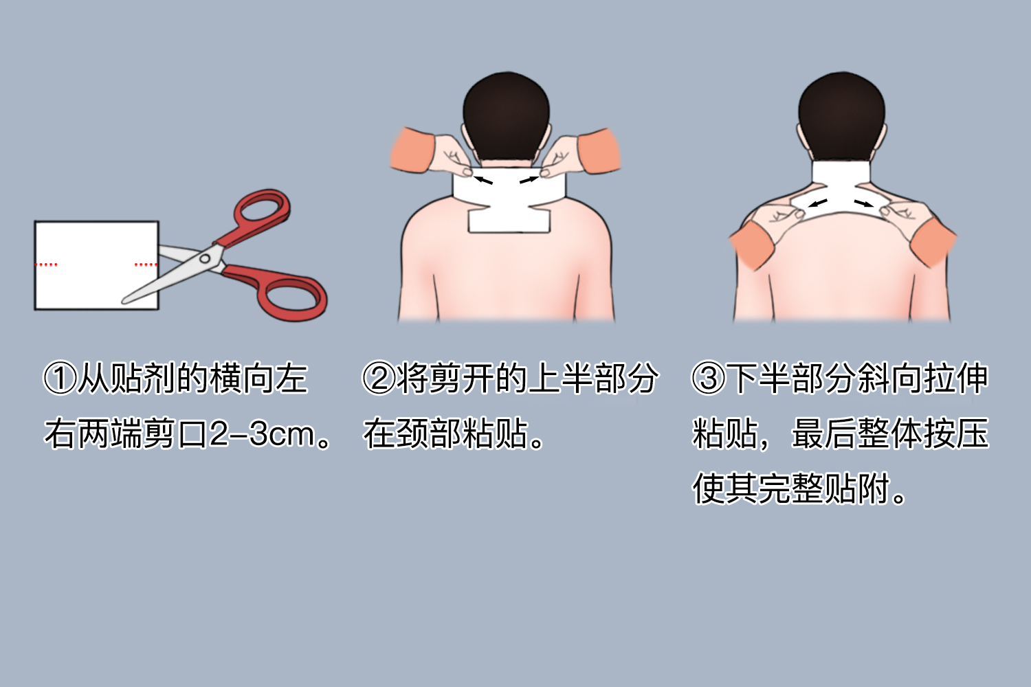氟比洛芬凝胶贴膏贴附颈部图