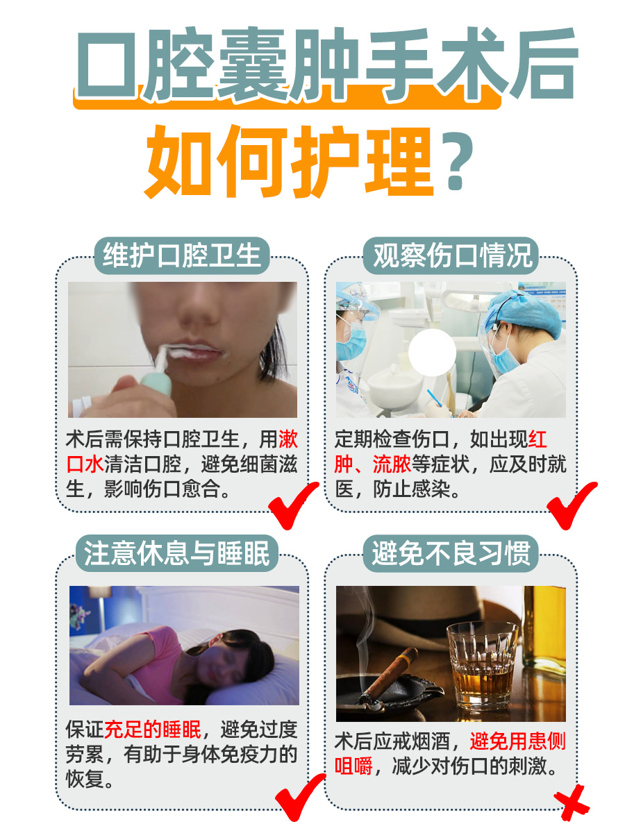 口腔囊肿手术后，究竟多久能正常吃东西？速看