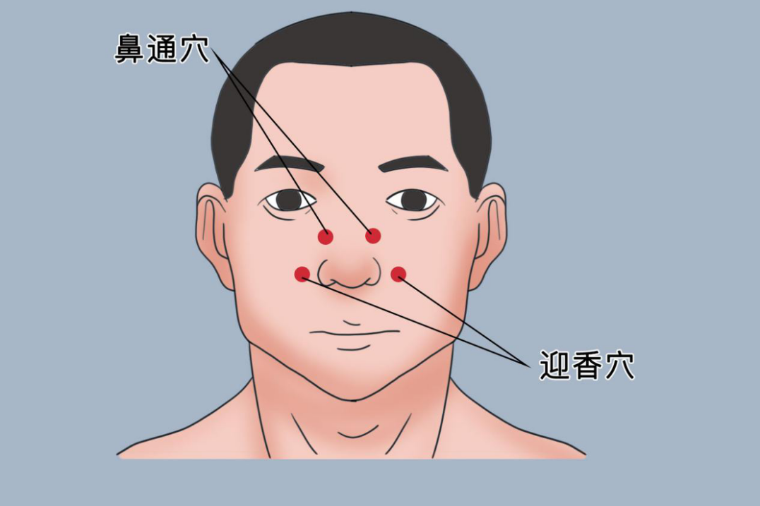 鼻通穴位置图 鼻通穴位置图