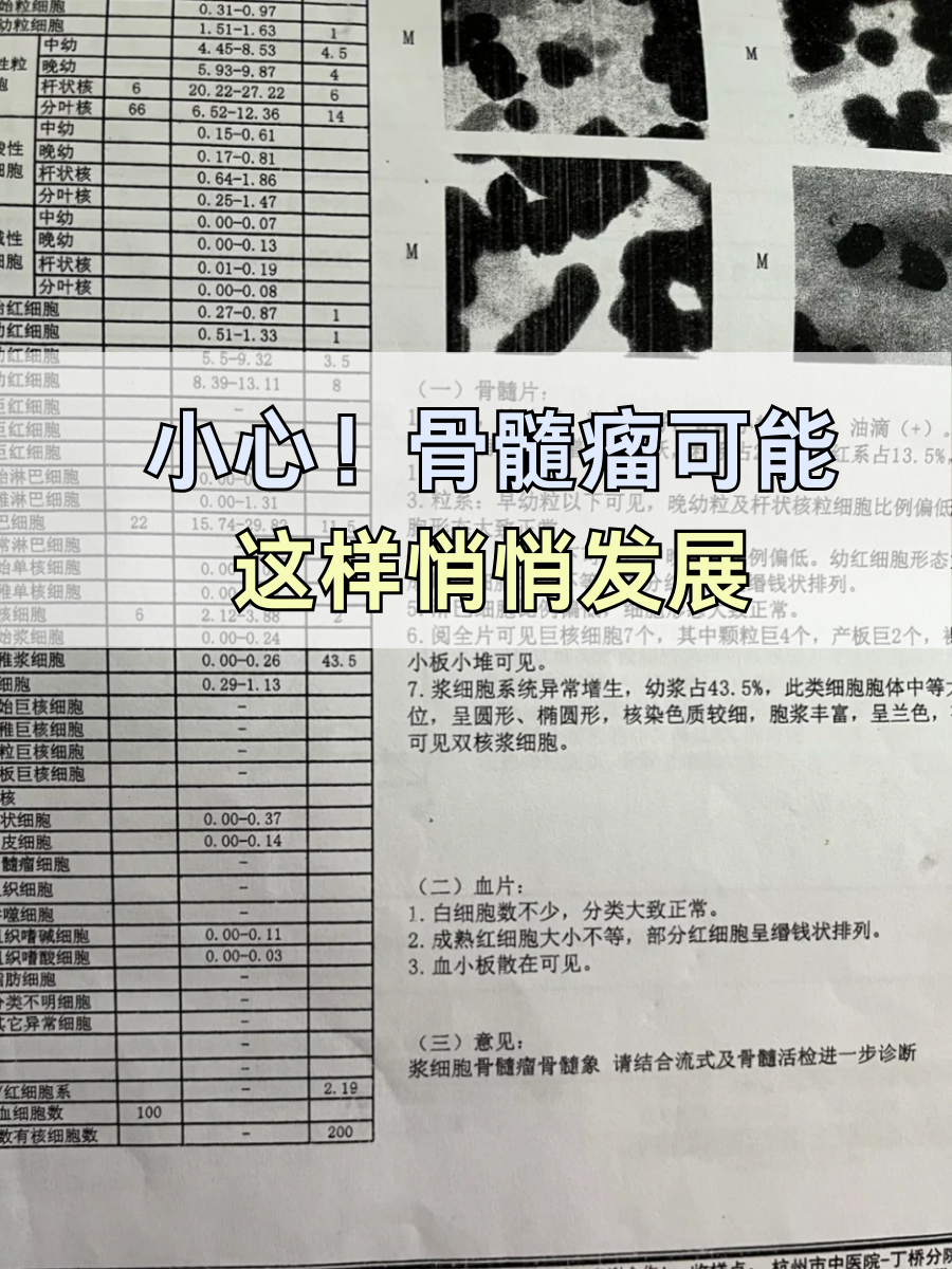 小心！骨髓瘤可能这样悄悄发展