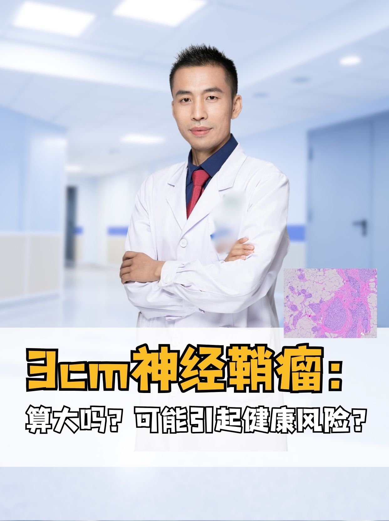 3cm神经鞘瘤：算大吗？可能引起健康风险？