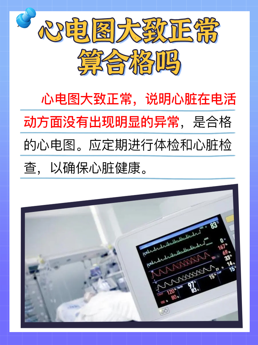 心电图大致正常算合格吗？医生为你解答
