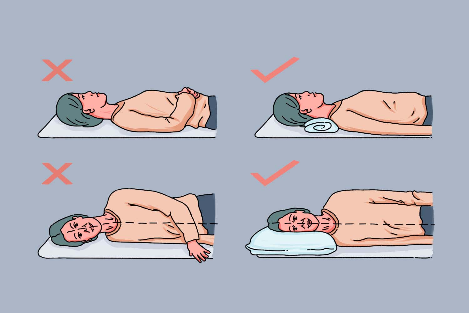 颈椎病正确睡觉姿势示意图 颈椎病正确睡觉姿势示意图
