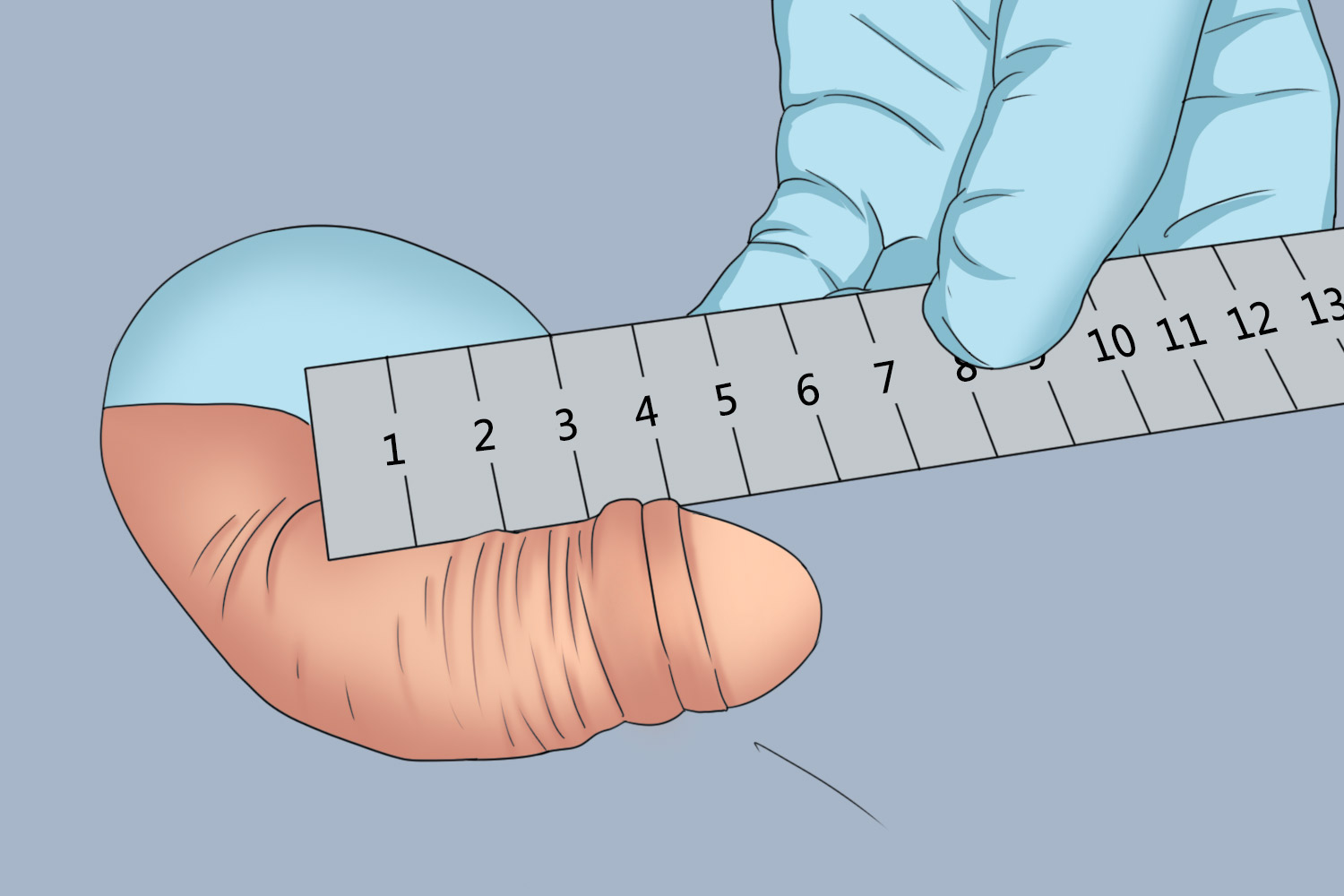 阴茎短小图 阴茎短小图