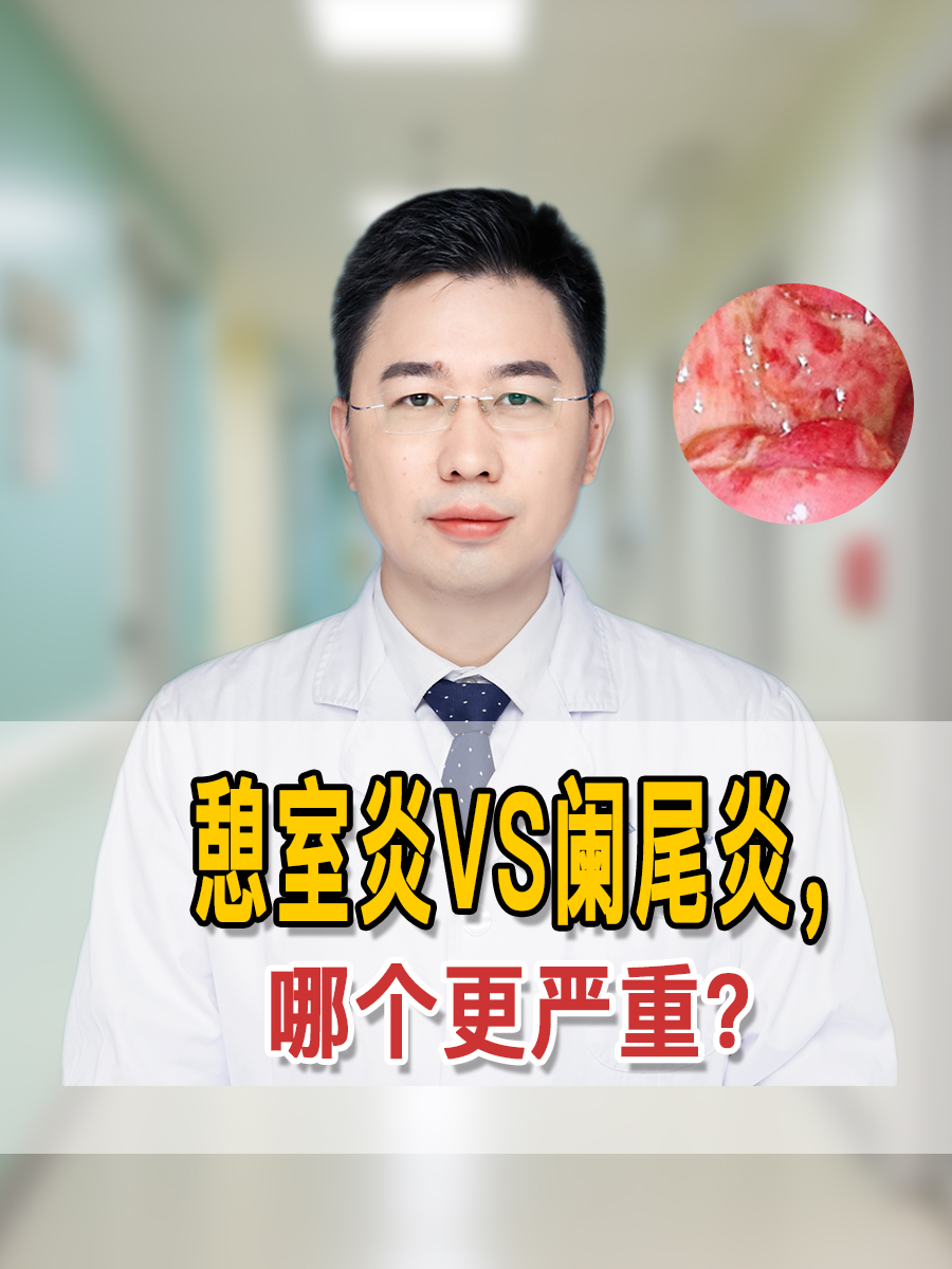 憩室炎VS阑尾炎，哪个更严重？