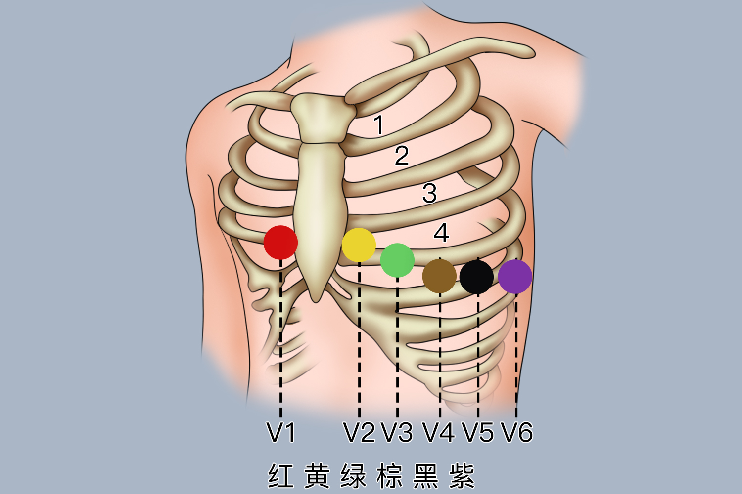 胸导联连接颜色顺序