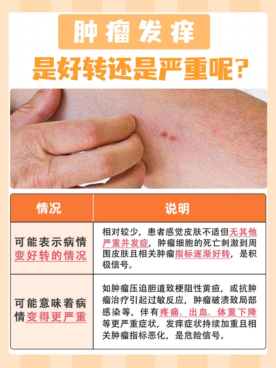 肿瘤发痒，是变好转还是更严重？