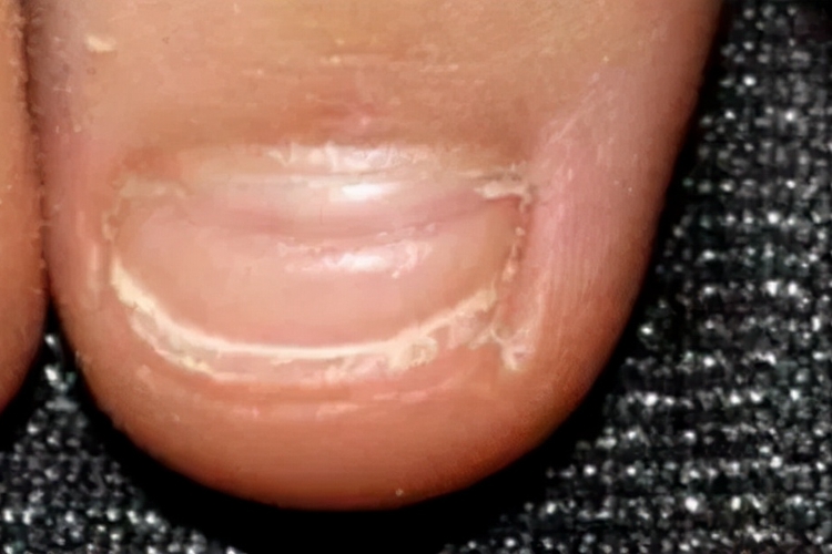 甲横沟图 甲横沟图